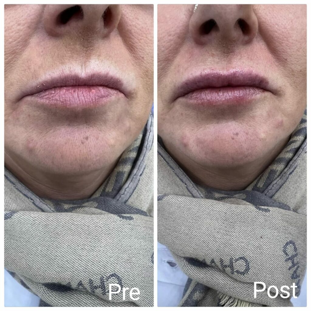 عيادة حقن فيلر في الغردقة